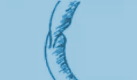 挖掘機密封件“扭轉”故障現象圖